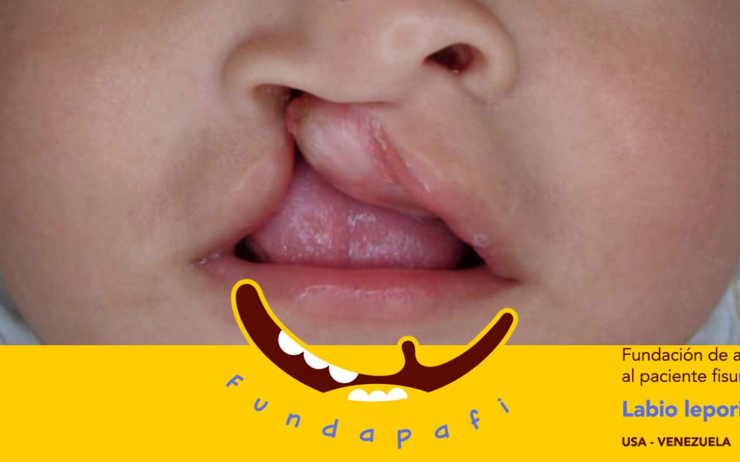 Fundapafi Help Us Gift smiles and change lives